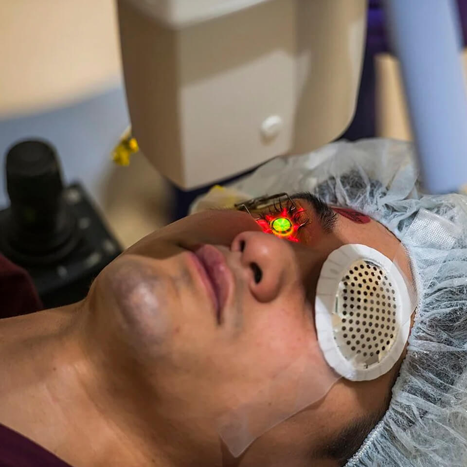 iromed_cf_x-linker_6 (1)
